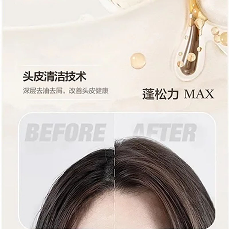 韩芙雪头皮管理蓬松自在洗发水